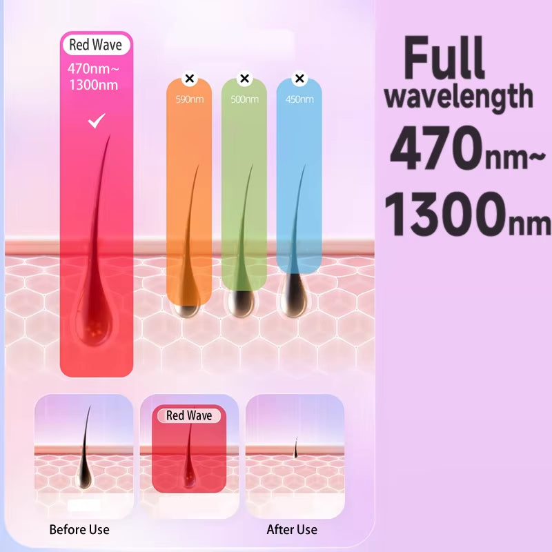 4 en 1 IPL Laser Hair Removal Device for Women ❗️
